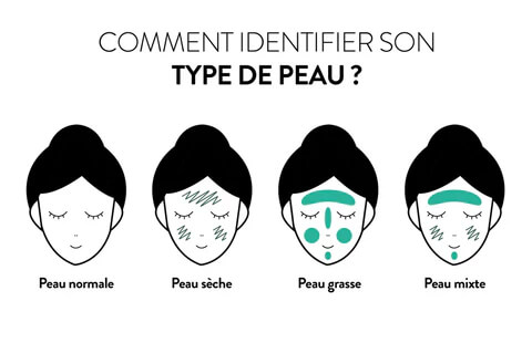types d'acné
